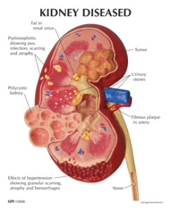 3260_KidneyPathologyCard-1