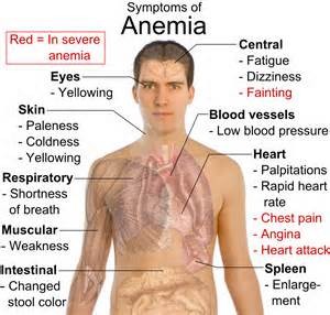anemia facts
