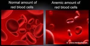 anemia picture