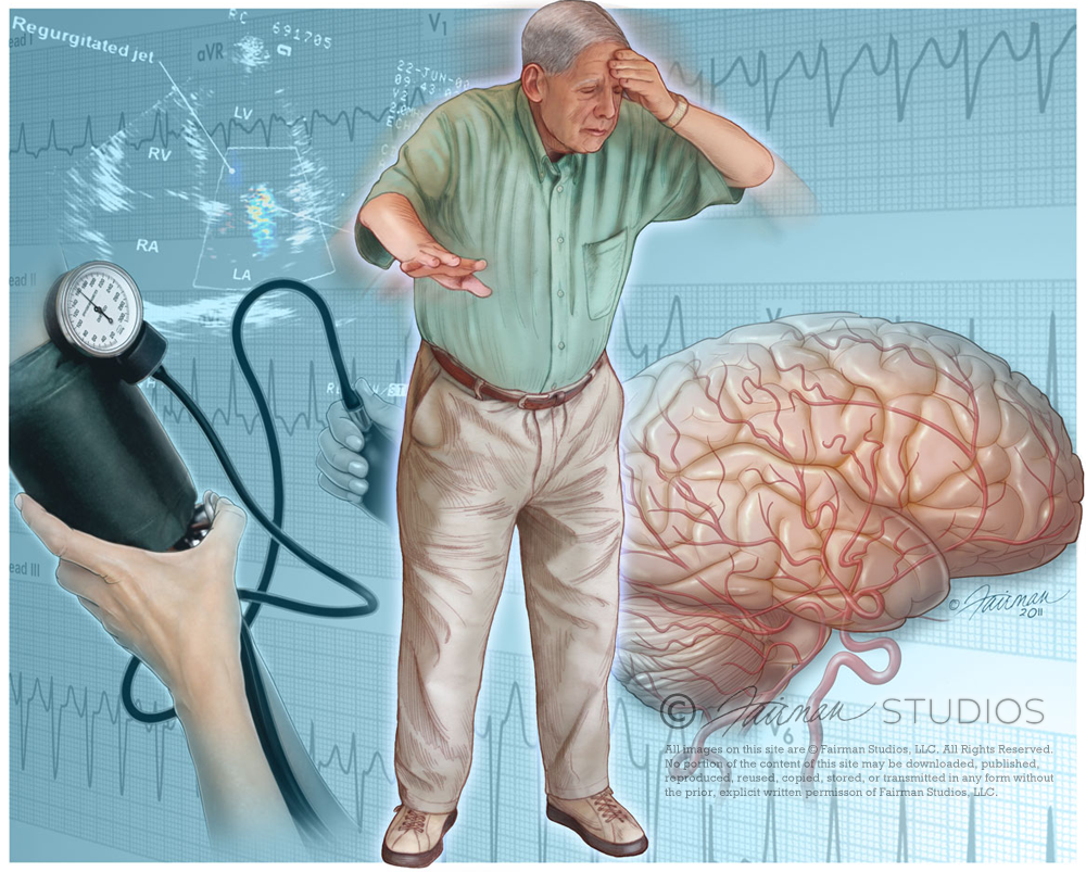 syncope prostate brain cancer evaluation fainting presyncope postural attack term drop american fairman temporary sudden consciousness loss known