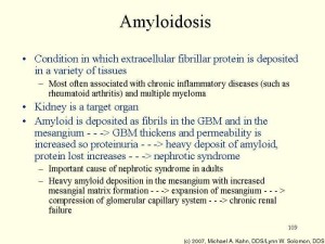 amyloidosis1