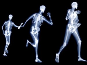 osteoporosis skeletal areas affected
