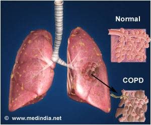COPD2