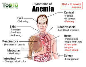 anemia2