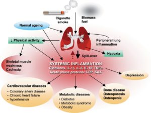 copd-part-iiic