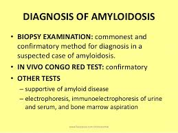 amyloidosis5