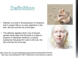 Albinism1a