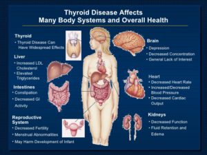 thyroid9