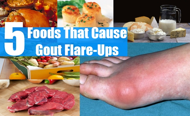 Part I What is Gout. Understanding the disease, its symptoms, and how ...
